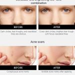 Concealer & Corrector Stick